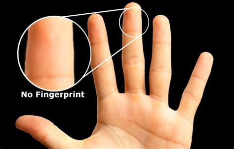 how to lose fingerprints naturally